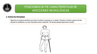 2. Actitud de Hemiplejía:
Determina una postura asimétrica que induce al enfermo a apoyarse en un bastón. Presenta el miembro superior del lado
afectado en semiflexión y la mano empuñada contra el abdomen. Pie del lado afectado ligeramente invertido.
POSICIONES DE PIE CARACTERÍSTICAS DE
AFECCIONES NEUROLÓGICAS
 