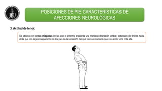 3. Actitud de tenor:
Se observa en ciertas miopatías en las que el enfermo presenta una marcada depresión lumbar, extensión del tronco hacia
atrás que con la gran separación de los pies da la sensación de que fuera un cantante que va a emitir una nota alta.
POSICIONES DE PIE CARACTERÍSTICAS DE
AFECCIONES NEUROLÓGICAS
 