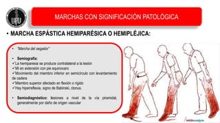• MARCHA ESPÁSTICA HEMIPARÉSICA O HEMIPLÉJICA:
• “Marcha del segador”
• Semiografía:
La hemiparesia se produce contralateral a la lesión
MI en extensión con pie equinovaro
Movimiento del miembro inferior en semicírculo con levantamiento
de cadera
Miembro superior afectado en flexión o rígido
Hay hiperreflexia, signo de Babinski, clonus.
• Semiodiagnóstico: lesiones a nivel de la vía piramidal,
generalmente por daño de origen vascular
MARCHAS CON SIGNIFICACIÓN PATOLÓGICA
 