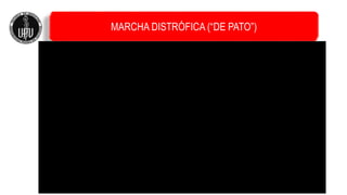 MARCHA DISTRÓFICA (“DE PATO”)
 