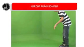MARCHA PARKINSONIANA
 