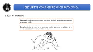 Semiografía: paciente coloca sobre sus muslos una almohada, y permaneciendo sentado,
se recuestan en ella.
2. Signo del almohadón:
Semiodiagnóstico: se observa en casos de grandes derrames pericárdicos o de
corazones considerablemente aumentados de volumen.
DECÚBITOS CON SIGNIFICACIÓN PATOLÓGICA:
 