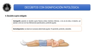 4. Decúbito supino obligado:
Semiografía: paciente en decúbito supino flexiona ambos miembros inferiores, o de uno de ellos, el derecho, por
ejemplo, como se ve en las inflamaciones apendiculares y peritonitis agudas.
Semiodiagnóstico: se observa en procesos abdominales agudos  apendicitis, peritonitis, colecistitis.
DECÚBITOS CON SIGNIFICACIÓN PATOLÓGICA:
 