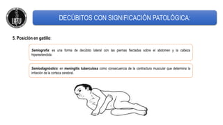 5. Posición en gatillo:
Semiografía: es una forma de decúbito lateral con las piernas flectadas sobre el abdomen y la cabeza
hiperextendida.
Semiodiagnóstico: en meningitis tuberculosa como consecuencia de la contractura muscular que determina la
irritación de la corteza cerebral.
DECÚBITOS CON SIGNIFICACIÓN PATOLÓGICA:
 