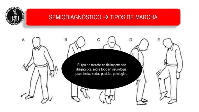 Marcha y decúbito final
