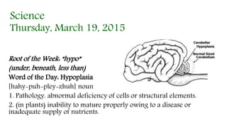 Science
Thursday, March 19, 2015
Root of the Week: “hypo”
(under, beneath, less than)
Word of the Day: Hypoplasia
[hahy-puh-pley-zhuh] noun
1. Pathology. abnormal deficiency of cells or structural elements.
2. (in plants) inability to mature properly owing to a disease or
inadequate supply of nutrients.
 