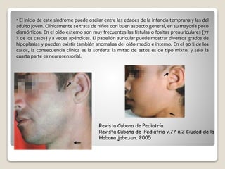 • El inicio de este síndrome puede oscilar entre las edades de la infancia temprana y las del
adulto joven. Clínicamente se trata de niños con buen aspecto general, en su mayoría poco
dismórficos. En el oído externo son muy frecuentes las fístulas o fositas preauriculares (77
% de los casos) y a veces apéndices. El pabellón auricular puede mostrar diversos grados de
hipoplasias y pueden existir también anomalías del oído medio e interno. En el 90 % de los
casos, la consecuencia clínica es la sordera: la mitad de estos es de tipo mixto, y sólo la
cuarta parte es neurosensorial.
Revista Cubana de Pediatría
Revista Cubana de Pediatría v.77 n.2 Ciudad de la
Habana jabr.-un. 2005
 