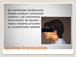 Quistes branquiales
 Se manifiestan tardíamente.
 Pueden producir tumoración
indolora y de crecimiento lento.
 Acumulación de líquidos y de
restos celulares procedentes de
su revestimiento epitelial.
 