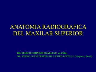 ANATOMIA RADIOGRAFICA DEL MAXILAR SUPERIOR DR. MARCO CORNEJO OVALLE (U. de Chile) DR. SERGIO LUCIO PEREIRA DE CASTRO LOPES (U. Campinas, Brasil) 