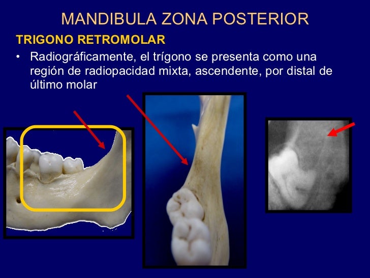 Marco Cornejo Anatomia Maxilares 2009