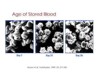 Age of Stored Blood
Hovav et al. Transfusion. 1999; 39: 277-281.
 