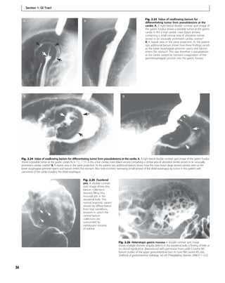 Barium study | PDF