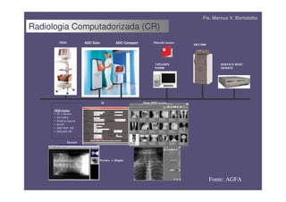 Fís. Marcus V. Bortolotto

Radiologia Computadorizada (CR)
         PRID             ADC Solo          ADC Compact          Plates&Cassetes
                                                                                   DRY3000
                                                                                     DR AR 3000
                                                                                       YST         a   b




                                                                  VIPS,DIPS                                   SERVICE HOST
                                                                  PS5000                                      MODEM




                                     Id                   Main DIPS screen

      PRID-Station
      • PC + Monitor
      • ID TABLE
      • BASE & Suporte
      • ID SW
      • PREVIEW SW
      • RISLINK SW



                Preview




                                 Preview x Display




                                                                                                           Fonte: AGFA
 