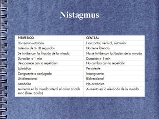 Nistagmus
 