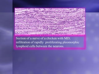 Section of a nerve of a chicken with MD;
infiltration of rapidly proliferating pleomorphic
lymphoid cells between the neurons.
 