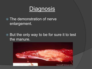 Diagnosis
 The demonstration of nerve
enlargement.
 But the only way to be for sure it to test
the manure.
 