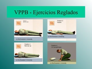 VPPB - Ejercicios Reglados 
