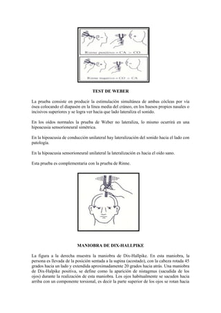 TEST DE WEBER
La prueba consiste en producir la estimulación simultánea de ambas cócleas por vía
ósea colocando el diapasón en la línea media del cráneo, en los huesos propios nasales o
incisivos superiores y se logra ver hacia que lado lateraliza el sonido.
En los oídos normales la prueba de Weber no lateraliza, lo mismo ocurrirá en una
hipoacusia sensorioneural simétrica.
En la hipoacusia de conducción unilateral hay lateralización del sonido hacia el lado con
patología.
En la hipoacusia sensorioneural unilateral la lateralización es hacia el oído sano.
Esta prueba es complementaria con la prueba de Rinne.
MANIOBRA DE DIX-HALLPIKE
La figura a la derecha muestra la maniobra de Dix-Hallpike. En esta maniobra, la
persona es llevada de la posición sentada a la supina (acostado), con la cabeza rotada 45
grados hacia un lado y extendida aproximadamente 20 grados hacia atrás. Una maniobra
de Dix-Halpike positiva, se define como la aparición de nistagmus (sacudida de los
ojos) durante la realización de esta maniobra. Los ojos habitualmente se sacuden hacia
arriba con un componente torsional, es decir la parte superior de los ojos se rotan hacia
 