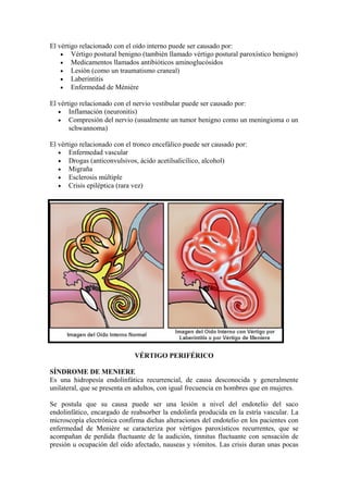 El vértigo relacionado con el oído interno puede ser causado por:
• Vértigo postural benigno (también llamado vértigo postural paroxístico benigno)
• Medicamentos llamados antibióticos aminoglucósidos
• Lesión (como un traumatismo craneal)
• Laberintitis
• Enfermedad de Ménière
El vértigo relacionado con el nervio vestibular puede ser causado por:
• Inflamación (neuronitis)
• Compresión del nervio (usualmente un tumor benigno como un meningioma o un
schwannoma)
El vértigo relacionado con el tronco encefálico puede ser causado por:
• Enfermedad vascular
• Drogas (anticonvulsivos, ácido acetilsalicílico, alcohol)
• Migraña
• Esclerosis múltiple
• Crisis epiléptica (rara vez)
VÉRTIGO PERIFÉRICO
SÍNDROME DE MENIERE
Es una hidropesía endolinfática recurrencial, de causa desconocida y generalmente
unilateral, que se presenta en adultos, con igual frecuencia en hombres que en mujeres.
Se postula que su causa puede ser una lesión a nivel del endotelio del saco
endolinfático, encargado de reabsorber la endolinfa producida en la estría vascular. La
microscopía electrónica confirma dichas alteraciones del endotelio en los pacientes con
enfermedad de Menière se caracteriza por vértigos paroxísticos recurrentes, que se
acompañan de perdida fluctuante de la audición, tinnitus fluctuante con sensación de
presión u ocupación del oído afectado, nauseas y vómitos. Las crisis duran unas pocas
 