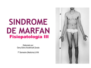 SINDROME
DE MARFAN
Fisiopatología III
Elaborado por:
Geny Elena Xicoténcatl Zavala
7º Semestre (Medicina) UVM
 