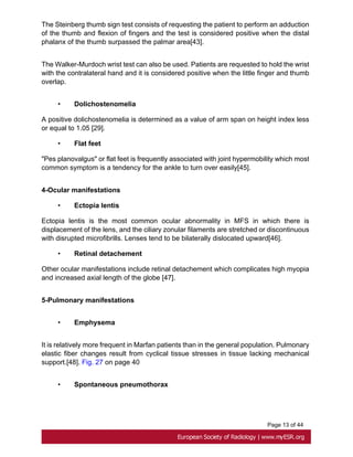 Page 13 of 44
The Steinberg thumb sign test consists of requesting the patient to perform an adduction
of the thumb and flexion of fingers and the test is considered positive when the distal
phalanx of the thumb surpassed the palmar area[43].
The Walker-Murdoch wrist test can also be used. Patients are requested to hold the wrist
with the contralateral hand and it is considered positive when the little finger and thumb
overlap.
• Dolichostenomelia
A positive dolichostenomelia is determined as a value of arm span on height index less
or equal to 1.05 [29].
• Flat feet
"Pes planovalgus" or flat feet is frequently associated with joint hypermobility which most
common symptom is a tendency for the ankle to turn over easily[45].
4-Ocular manifestations
• Ectopia lentis
Ectopia lentis is the most common ocular abnormality in MFS in which there is
displacement of the lens, and the ciliary zonular filaments are stretched or discontinuous
with disrupted microfibrills. Lenses tend to be bilaterally dislocated upward[46].
• Retinal detachement
Other ocular manifestations include retinal detachement which complicates high myopia
and increased axial length of the globe [47].
5-Pulmonary manifestations
• Emphysema
It is relatively more frequent in Marfan patients than in the general population. Pulmonary
elastic fiber changes result from cyclical tissue stresses in tissue lacking mechanical
support.[48]. Fig. 27 on page 40
• Spontaneous pneumothorax
 