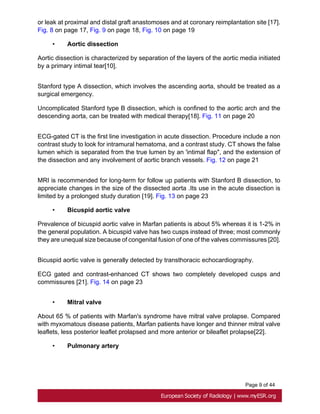 Page 9 of 44
or leak at proximal and distal graft anastomoses and at coronary reimplantation site [17].
Fig. 8 on page 17, Fig. 9 on page 18, Fig. 10 on page 19
• Aortic dissection
Aortic dissection is characterized by separation of the layers of the aortic media initiated
by a primary intimal tear[10].
Stanford type A dissection, which involves the ascending aorta, should be treated as a
surgical emergency.
Uncomplicated Stanford type B dissection, which is confined to the aortic arch and the
descending aorta, can be treated with medical therapy[18]. Fig. 11 on page 20
ECG-gated CT is the first line investigation in acute dissection. Procedure include a non
contrast study to look for intramural hematoma, and a contrast study. CT shows the false
lumen which is separated from the true lumen by an 'intimal flap", and the extension of
the dissection and any involvement of aortic branch vessels. Fig. 12 on page 21
MRI is recommended for long-term for follow up patients with Stanford B dissection, to
appreciate changes in the size of the dissected aorta .Its use in the acute dissection is
limited by a prolonged study duration [19]. Fig. 13 on page 23
• Bicuspid aortic valve
Prevalence of bicuspid aortic valve in Marfan patients is about 5% whereas it is 1-2% in
the general population. A bicuspid valve has two cusps instead of three; most commonly
they are unequal size because of congenital fusion of one of the valves commissures [20].
Bicuspid aortic valve is generally detected by transthoracic echocardiography.
ECG gated and contrast-enhanced CT shows two completely developed cusps and
commissures [21]. Fig. 14 on page 23
• Mitral valve
About 65 % of patients with Marfan's syndrome have mitral valve prolapse. Compared
with myxomatous disease patients, Marfan patients have longer and thinner mitral valve
leaflets, less posterior leaflet prolapsed and more anterior or bileaflet prolapse[22].
• Pulmonary artery
 