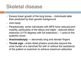 Skeletal disease
 Excess linear growth of the long bones – Individuals taller
than predicted by their genetic background
 Joint laxity
 Paradoxically, some individuals with MFS have reduced joint
mobility, particularly of the elbow and digits - reduced elbow
extension (≤170 degrees with full extension) – 1 point to the
systemic score
 Arachnodactyly — abnomally long and slender fingers
 Thumb sign - entire distal phalanx protrudes beyond the
ulnar border of a clenched fist with or without the assistance
of the patient or examiner to achieve maximum adduction
 