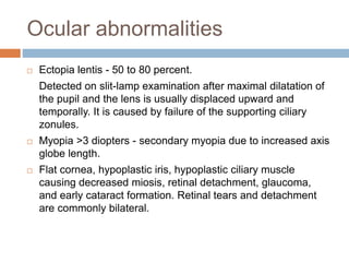 Ocular abnormalities
 Ectopia lentis - 50 to 80 percent.
Detected on slit-lamp examination after maximal dilatation of
the pupil and the lens is usually displaced upward and
temporally. It is caused by failure of the supporting ciliary
zonules.
 Myopia >3 diopters - secondary myopia due to increased axis
globe length.
 Flat cornea, hypoplastic iris, hypoplastic ciliary muscle
causing decreased miosis, retinal detachment, glaucoma,
and early cataract formation. Retinal tears and detachment
are commonly bilateral.
 