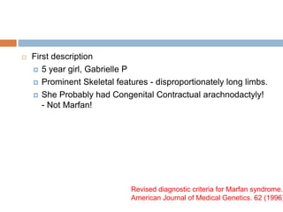  First description
 5 year girl, Gabrielle P
 Prominent Skeletal features - disproportionately long limbs.
 She Probably had Congenital Contractual arachnodactyly!
- Not Marfan!
Revised diagnostic criteria for Marfan syndrome.
American Journal of Medical Genetics. 62 (1996)
 