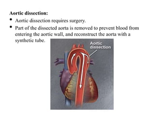 Aortic dissection:
• Aortic dissection requires surgery.
• Part of the dissected aorta is removed to prevent blood from
entering the aortic wall, and reconstruct the aorta with a
synthetic tube.
 