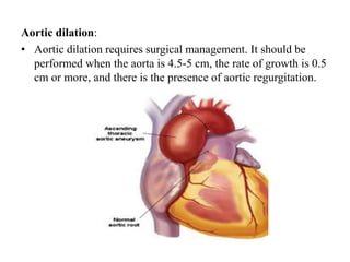 Aortic dilation:
• Aortic dilation requires surgical management. It should be
performed when the aorta is 4.5-5 cm, the rate of growth is 0.5
cm or more, and there is the presence of aortic regurgitation.
 