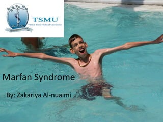 Marfan Syndrome
By: Zakariya Al-nuaimi
 