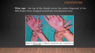 CONTINUED
• Wrist sign - the top of the thumb covers the entire fingernail of the
fifth finger when wrapped around the contralateral wrist.
 