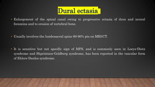 Dural ectasia
• Enlargement of the spinal canal owing to progressive ectasia of dura and neural
foramina and to erosion of vertebral bone.
• Usually involves the lumbosacral spine 60-90% pts on MRI/CT.
• It is sensitive but not specific sign of MFS, and is commonly seen in Loeys-Dietz
syndrome and Shprintzen-Goldberg syndrome, has been reported in the vascular form
of Ehlers-Danlos syndrome.
 