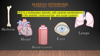 MARFAN SYNDROME
MFS is a multisystem disorder, with cardinal manifestations
in the skeletal, cardiovascular, and ocular systems.
 