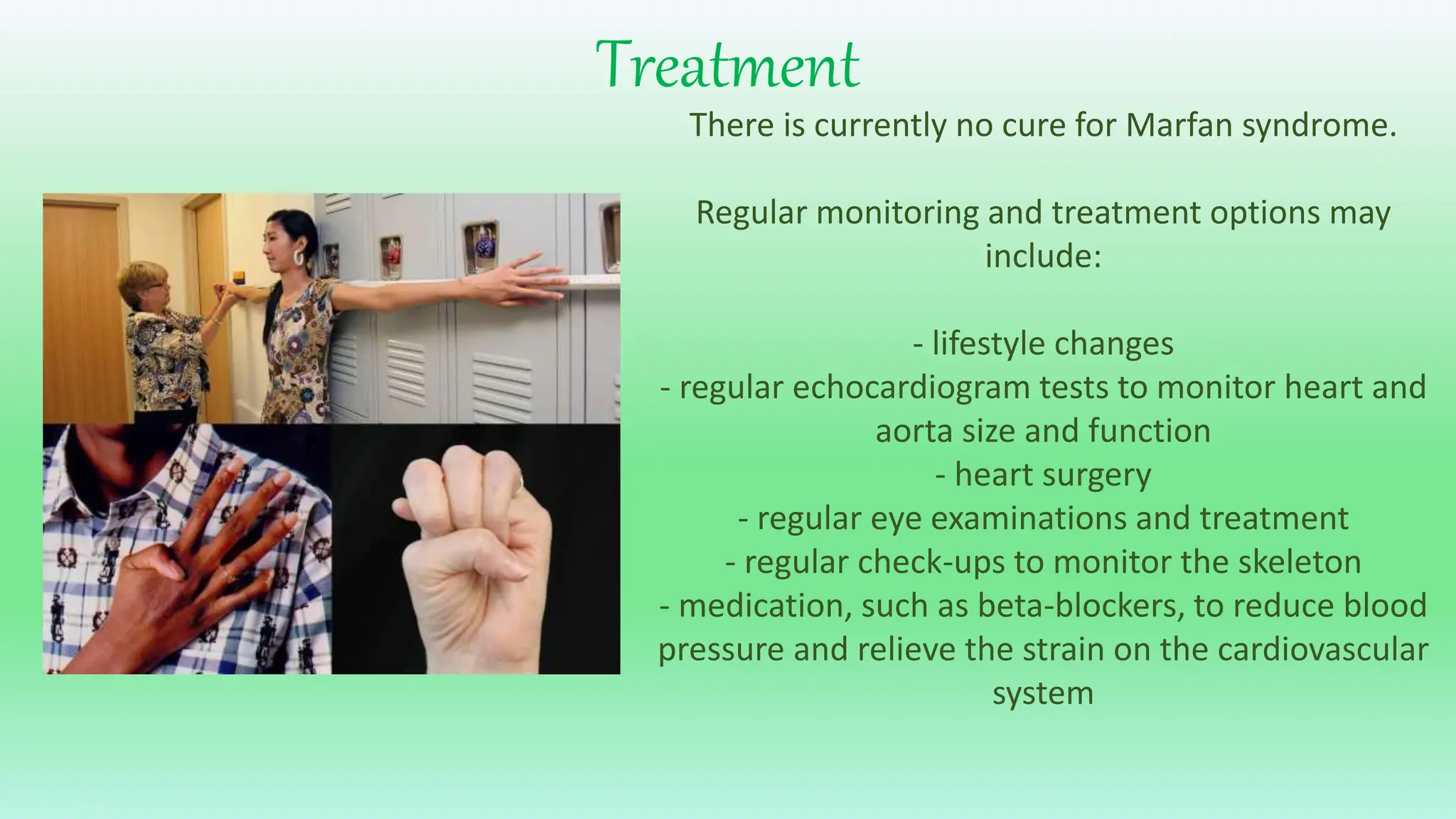 Marfan Syndrome.pptx