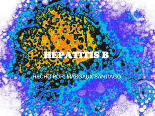 HEPATITIS B HECHO POR: MARGAUX SANTIAGO 