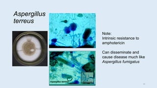 Aspergillus
terreus
Note:
Intrinsic resistance to
amphotericin
Can disseminate and
cause disease much like
Aspergillus fumigatus
10
 