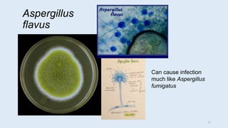 Aspergillus
flavus
Can cause infection
much like Aspergillus
fumigatus
11
 