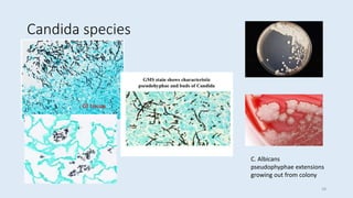 Candida species
GI tissue
C. Albicans
pseudophyphae extensions
growing out from colony
28
 