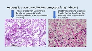 Aspergillus compared to Mucormycete fungi (Mucor)
Broad hyphae rare/no septations
Broader hyphae than Aspergillus
Branching more irregular/some
at 90* angle
Thinner hyphae than Mucormycete
Regular septations, 45* angle
branching referred to as dichotomous
branching
5
 