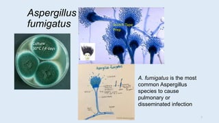 Aspergillus
fumigatus
Fungus ball
Culture
30*C / 4 days
Scotch Tape
Prep
A. fumigatus is the most
common Aspergillus
species to cause
pulmonary or
disseminated infection
7
 
