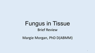 Fungus in Tissue
Brief Review
Margie Morgan, PhD D(ABMM)
1
 