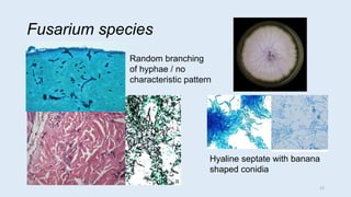 Fusarium species
Random branching
of hyphae / no
characteristic pattern
Hyaline septate with banana
shaped conidia
12
 