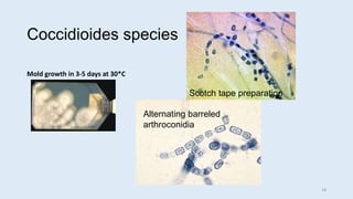 Coccidioides species
Mold growth in 3-5 days at 30*C
Alternating barreled
arthroconidia
Scotch tape preparation
18
 