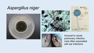 Aspergillus niger
Unusual to cause
pulmonary infection,
most often associated
with ear infections
9
 