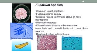 Fusarium species
•Common in nature/plants
•Fuchsia colored colony
•Disease related to immune status of host/
neutropenia
•Infections reported:
•Disseminated disease in bone marrow
transplants and corneal infections in contact lens
wearers
•Random hyphae in fixed tissue
Banana boat shaped spore
104
 