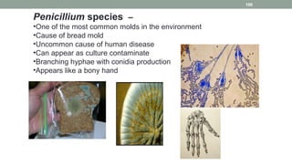 Penicillium species –
•One of the most common molds in the environment
•Cause of bread mold
•Uncommon cause of human disease
•Can appear as culture contaminate
•Branching hyphae with conidia production
•Appears like a bony hand
106
 