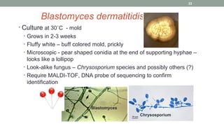 Blastomyces dermatitidis
• Culture at 30˚C - mold
• Grows in 2-3 weeks
• Fluffy white – buff colored mold, prickly
• Microscopic - pear shaped conidia at the end of supporting hyphae –
looks like a lollipop
• Look-alike fungus – Chrysosporium species and possibly others (?)
• Require MALDI-TOF, DNA probe of sequencing to confirm
identification
Blastomyces
Chrysosporium
33
 