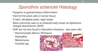 Sporothrix schenckii Histology
• Pyogenic to granulomatous inflammation
• Hard to find yeast cells in human tissue
• If seen, elongated yeast, cigar shape
• More commonly seen is an Asteroid body known as Splendore-
Hoeppli phenomenon (SHP)
• SHP are not only found in Sporothrix infections, also seen with:
• Mucormycetes (Mucor, Rhizopus)
• Aspergillus
• Blastomyces
• Candida spp
49
 